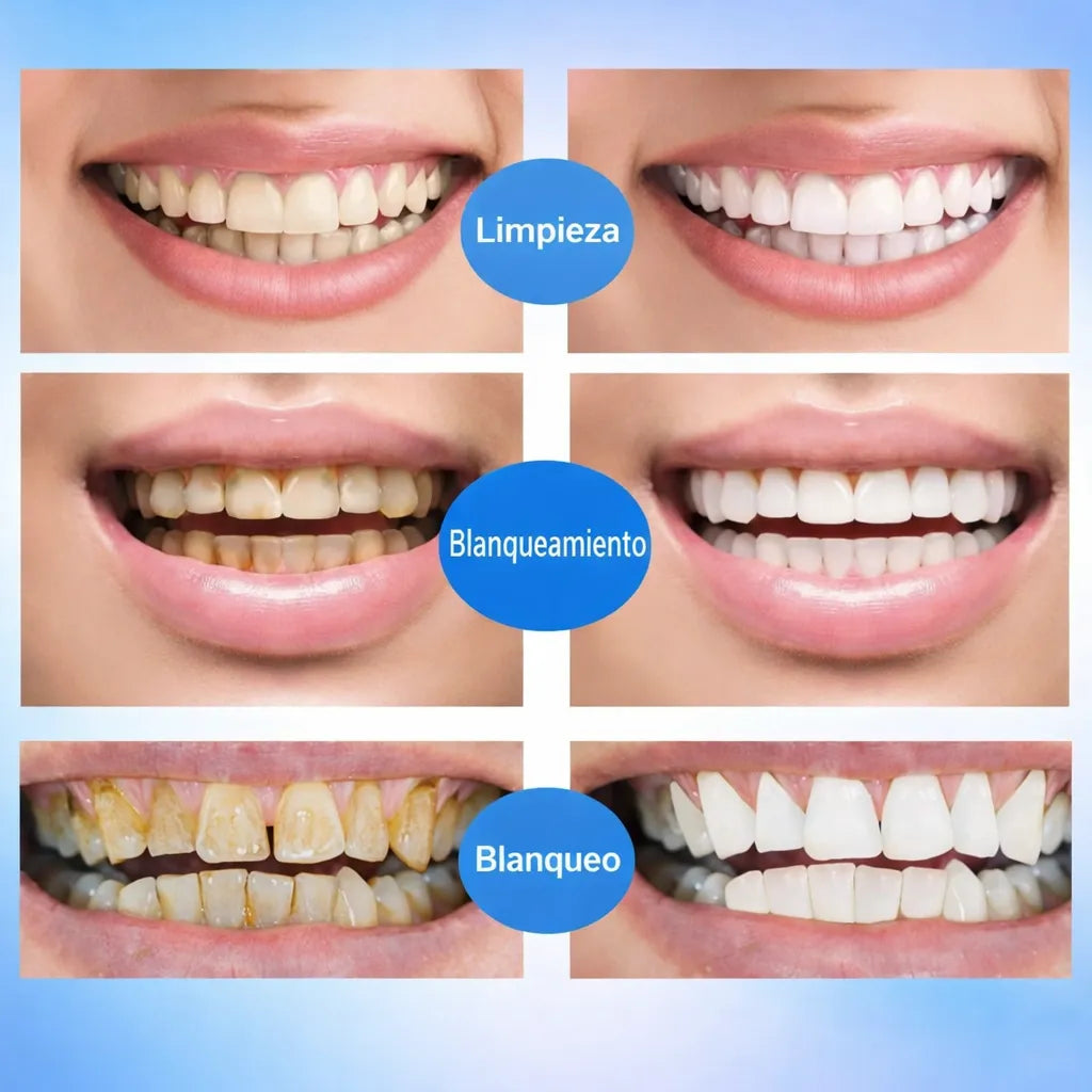 Blanqueador Dental En Gel Premium